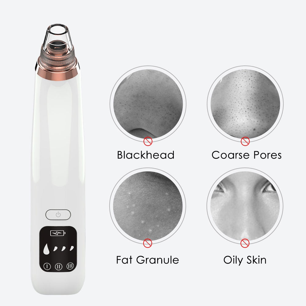 Blackhead Remover Vacuum Pore Cleaner Suction Cleaning Face Care Black Head Cleaner Acne Extractor Diamond Microdermabrasion