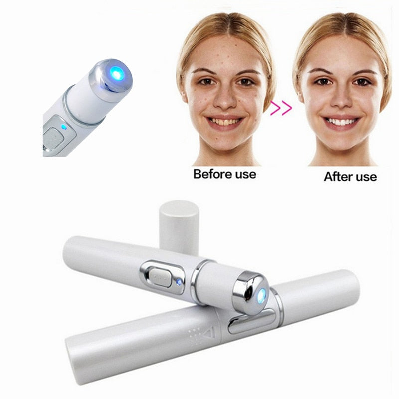 Blue Light Therapy Laser Pen Portable Shrink Pores Black Spots Freckle Scar acne Pimple Removal Beauty Machine Treatment Skincare
